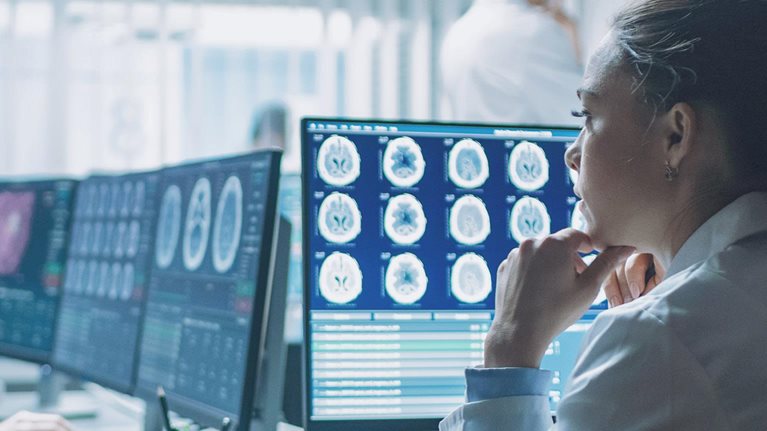 Designing an agile transformation in pharma R&D