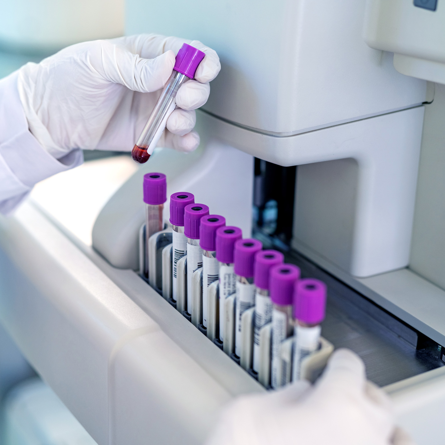 Close-up of a doctors hand looking at blood sample test tube in a machine